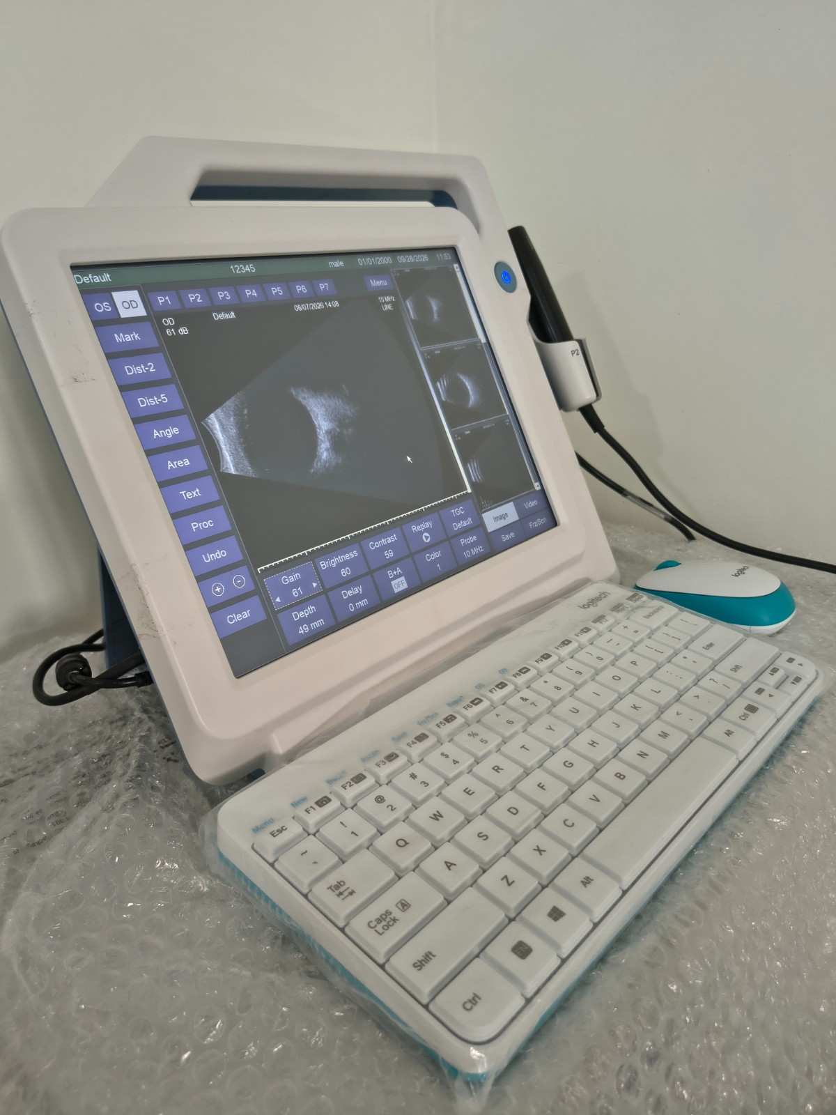 Ultrasound B & A scan